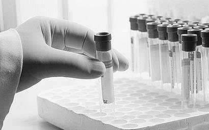 迈克生物10转20派2.7元机构投资者 抱团入驻